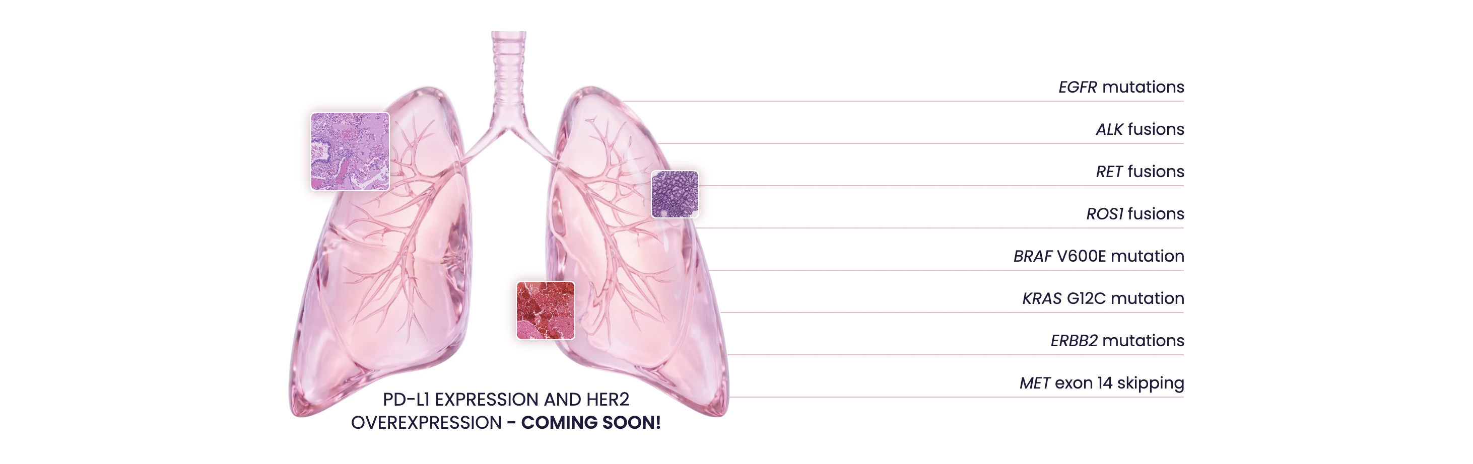 Lung Prediction Panel biomarkers: EGFR mutations, ALK fusions, RET fusions, ROS1 fusions, BRAF V600E mutation, KRAS G12C mutation, ERBB2 mutations and MET exon 14 skipping. PD-L1 expression and HER2 overexpression are coming soon.