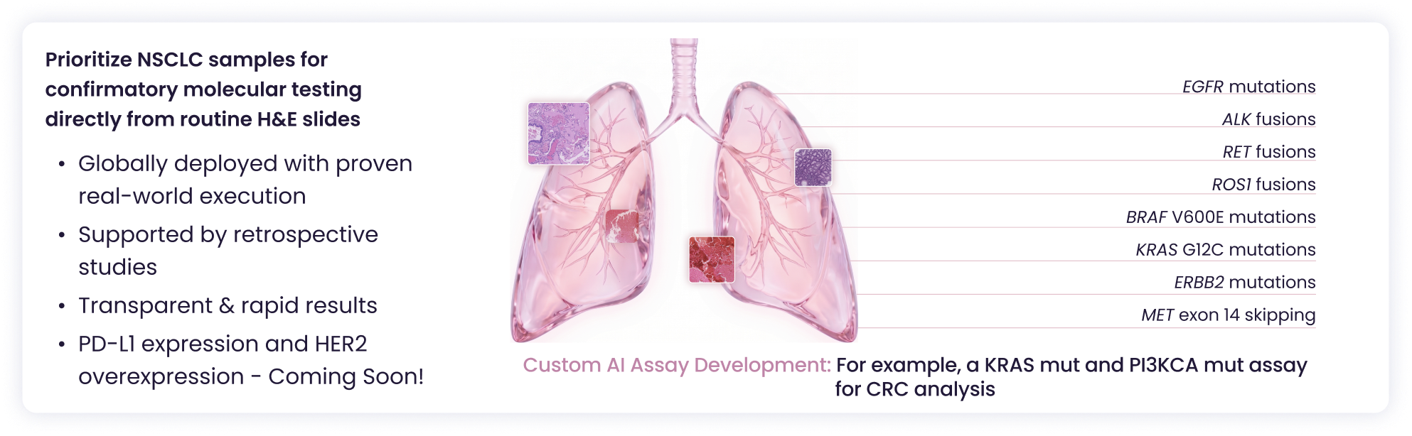 Lung Prediction Panel: prioritize NSCLC samples, with genomic alteration predictions and custom assay development.